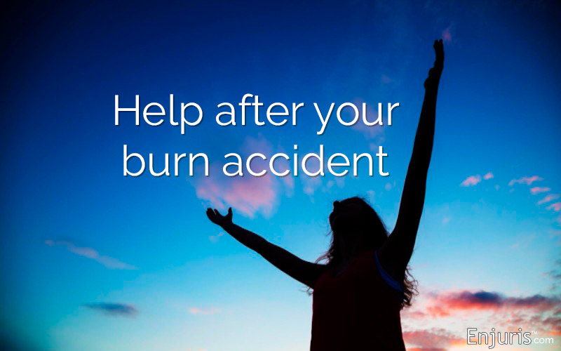 Burn accidents in Texas