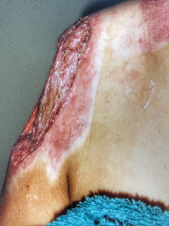Elizabeth Banks’ shoulder scar beginning to heal after motorcycle accident