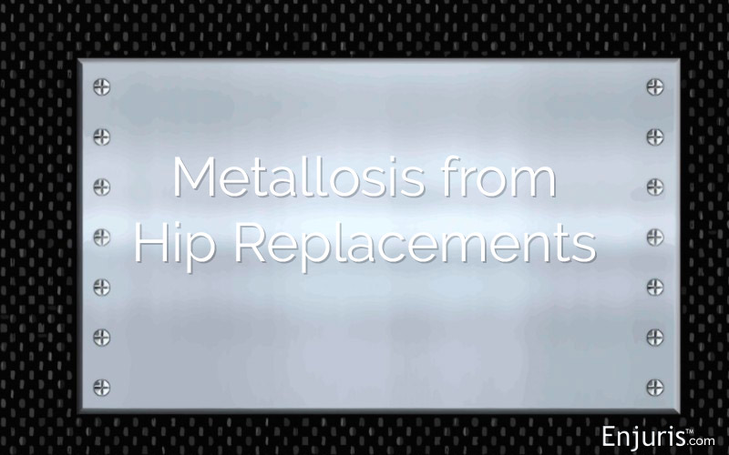 Hip Replacement Metallosis