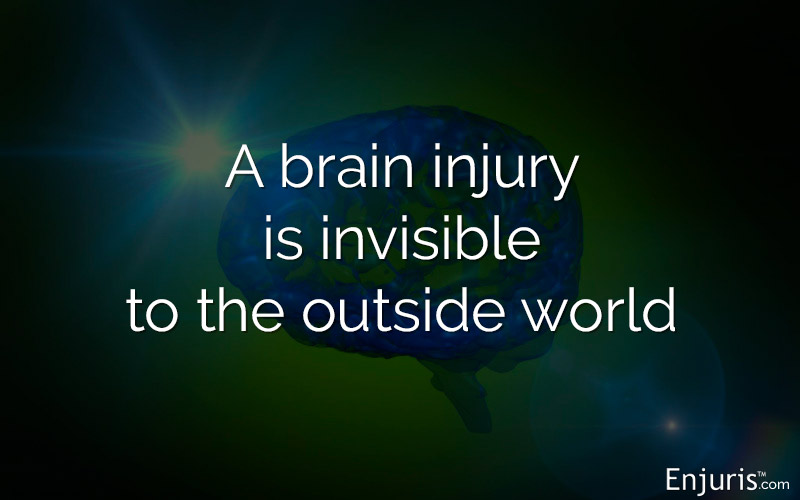 brain injuries concussions