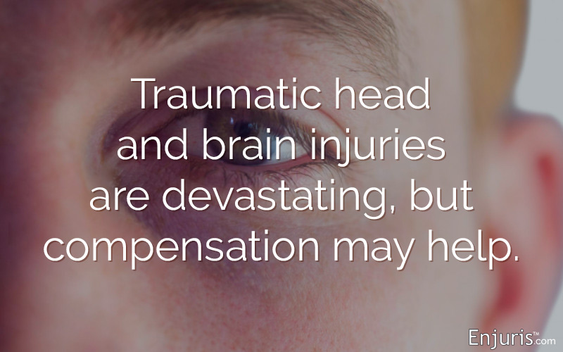 Texas head and brain injury lawsuits