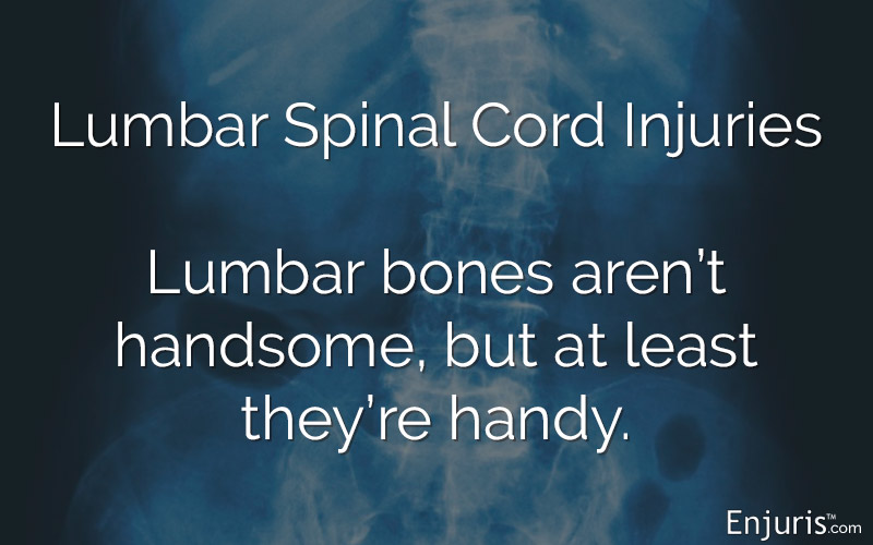 X-Ray, lumbar spine