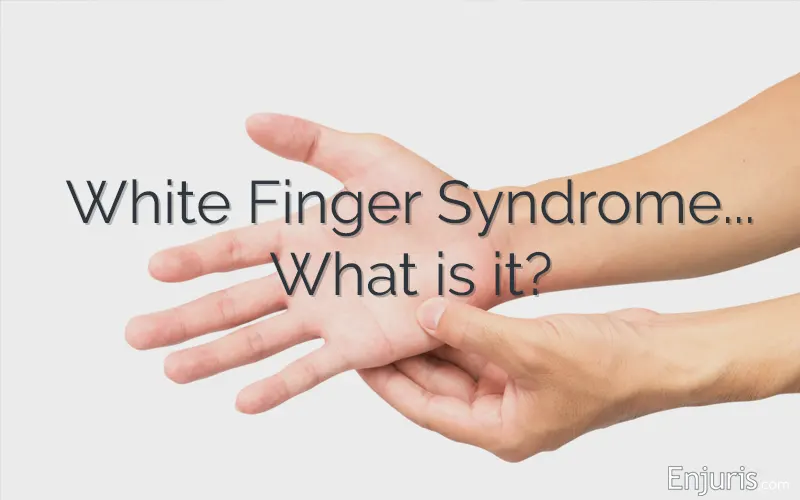 White finger syndrome